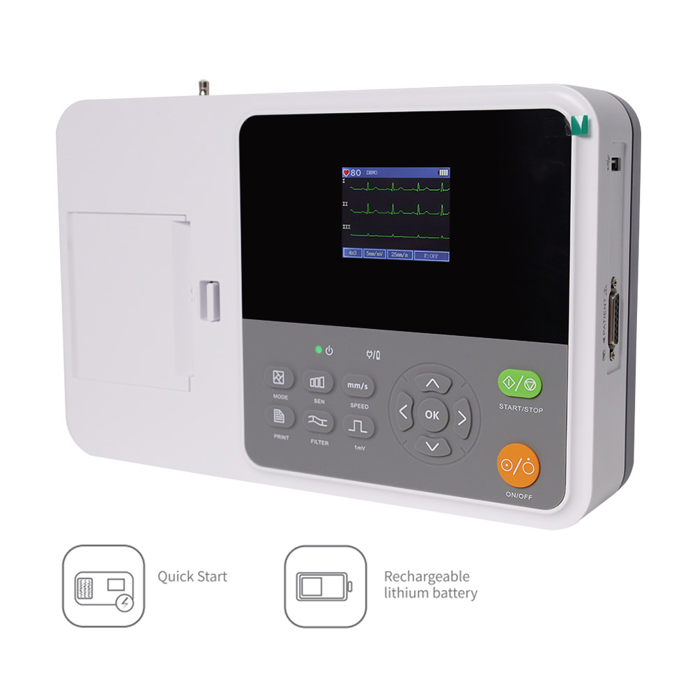 CONTEC E3 휴대용 디지털 3채널 12리드 심전도 - Ekg Ecg Machine Portable 리뷰 및 가격