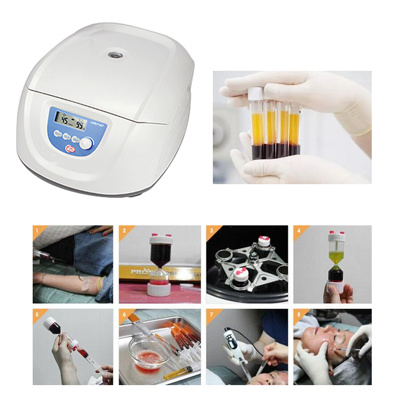 베스트셀러 의료용 혈액 PRP PRF CGF 원심분리기 - Medical Lab Center 리뷰 및 가격